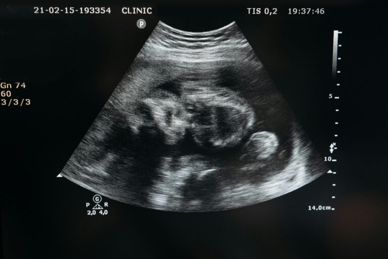 Ultrasound scan showing the image of an unborn child in the womb, highlighting pregnancy and healthcare.