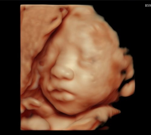 PHOTO-2024-12-27-01-05-35 PHOTO-2024-12-27-01-05-35